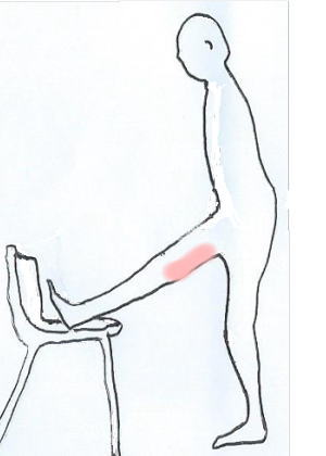 �n���X�g�����O�̃X�g���b�`